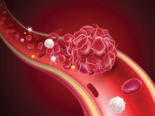 krvinky a trombóza