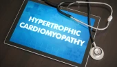 hypertrofická kardiomyopatie