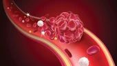 krvinky a trombóza