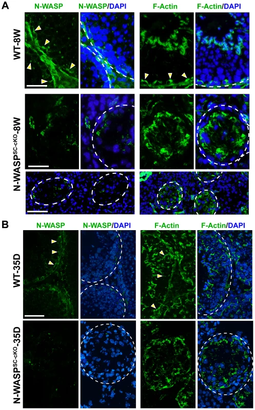 Sertoli cell-specific knockout of N-WASP leads to disorganization of F-actin in the seminiferous epithelium.