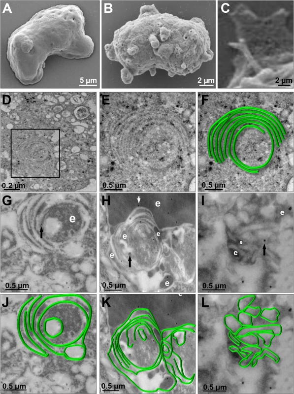 SEM and TEM of membranous helicoidally structures in <i>pNeoEhvps32-HA</i> transfected trophozoites.