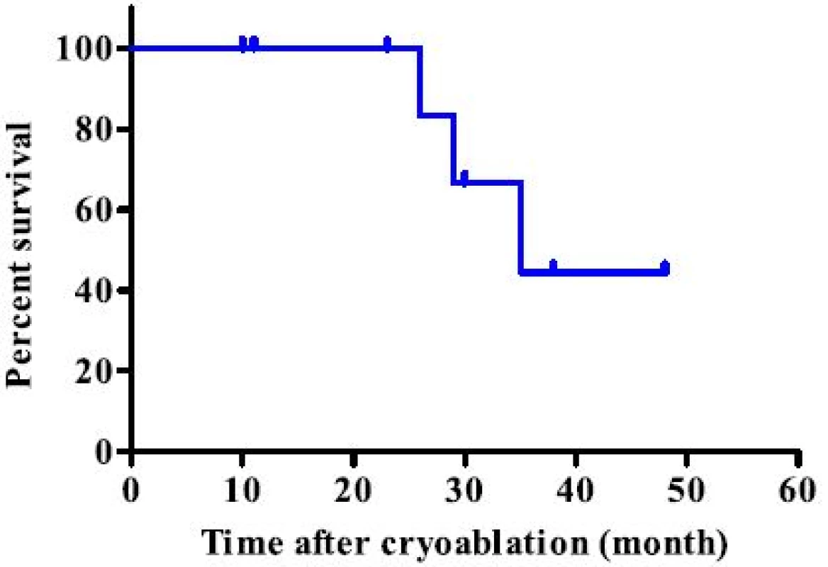 Kaplan - Meier survival curve analysis of the entire group. There was no local recurrence after cryoablation and the median survival was 35 months