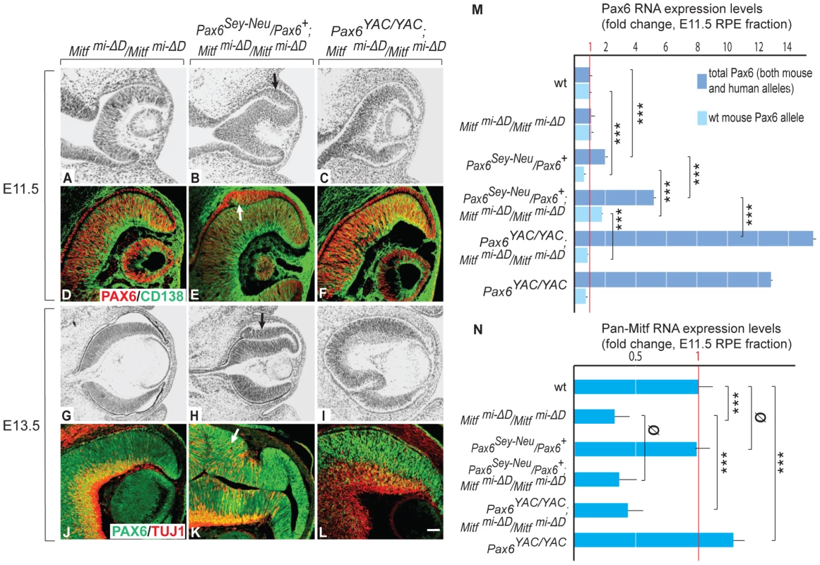 Gene dose of <i>Pax6</i> regulates dorsal RPE development in a hypomorphic <i>Mitf</i> mutant.