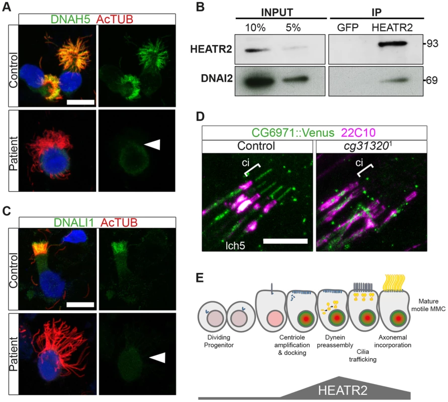 Cytoplasmic HEATR2 is required for the pre-assembly of axonemal dynein machinery necessary for motility.