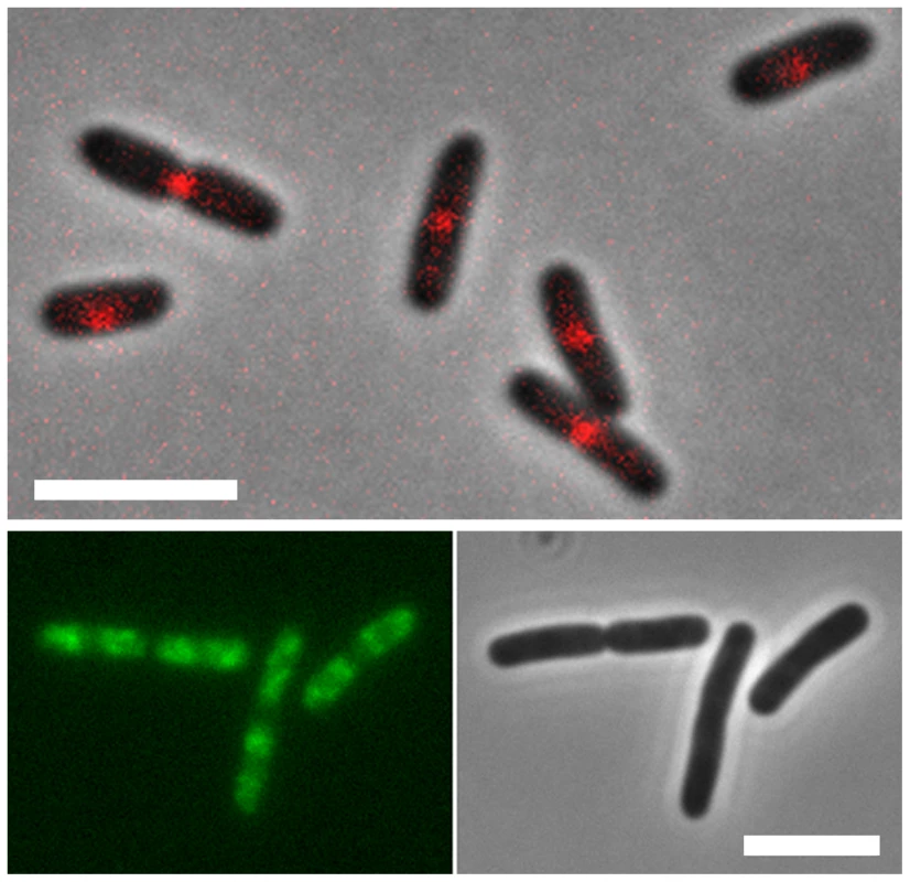 Localization of MatP and SlmA on the <i>E. coli</i> chromosome.