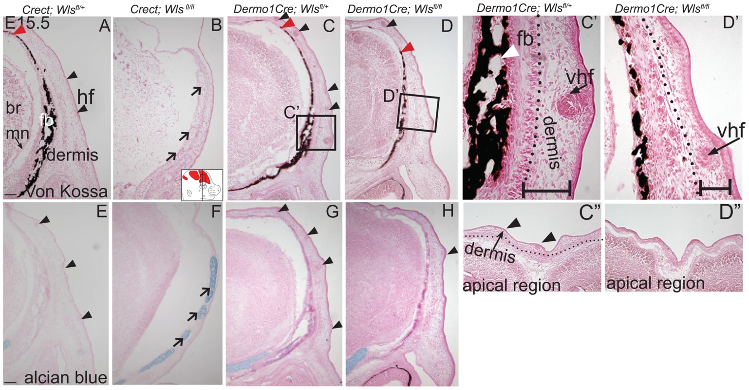 Distinct requirements for <i>Wntless</i> in the cranial ectoderm and mesenchyme.