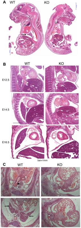 Histological analysis of <i>Asciz</i>-null embryos.