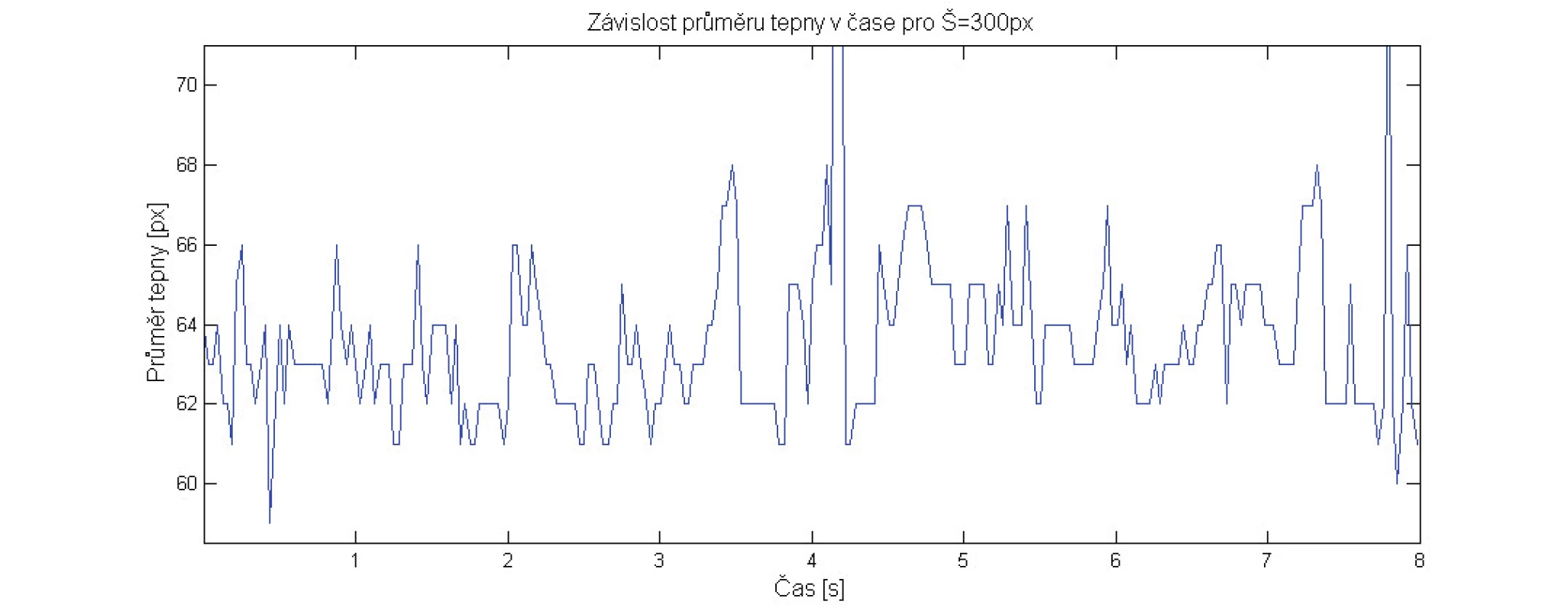 Graf závislosti průměru stehenní tepny v čase pro jasový profil W = 300 px obrazu.