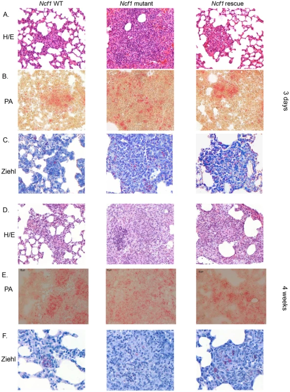 Role of the phagocyte NADPH oxidase in granuloma formation and BCG sequestration.