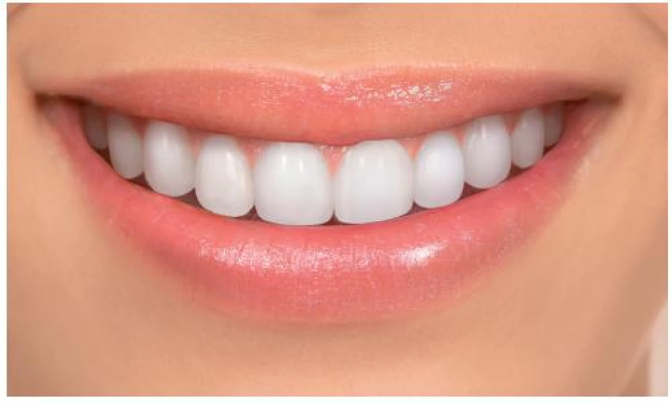Fotografie atraktivního úsměvu mladé ženy jako báze pro tvorbu jednostranných změn tvaru frontálních zubů