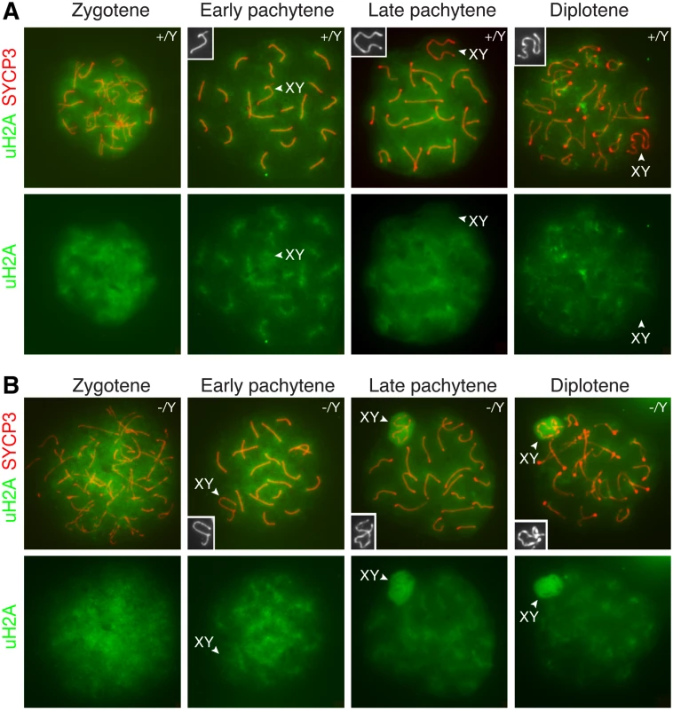 Increased H2A monoubiquitination in the XY body in <i>Scml2</i>-deficeint pachytene and diplotene spermatocytes.