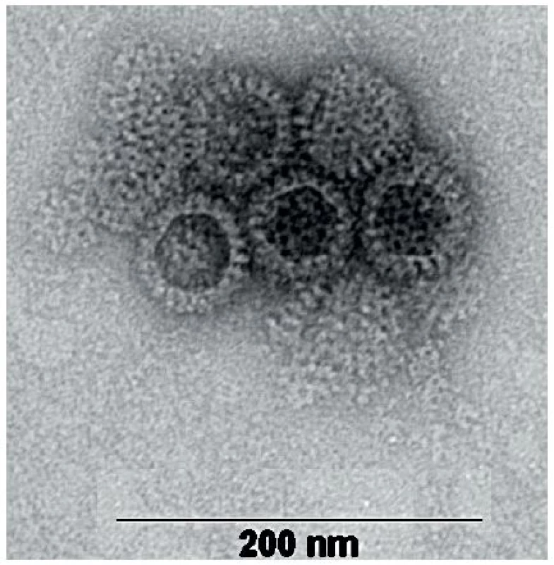 Snímek rotavirových částic – negativně barvený preparát zachycený transmisním elektronovým mikroskopem (autor MVDr. Pavel Kulich, Ph.D., laboratoř Elektronové mikroskopie Centra akreditovaných laboratoří, VÚVeL, Brno). Na základě elektronové mikroskopie je možné rotaviry odlišit od jiných virů pouze na úrovni rodů, struktury rotavirových částic jednotlivých druhů (RVA, RVB, RVC, atd.) jsou navzájem shodné.
Fig. 1. A transmission electron microscope photo of negatively dyed rotavirus particles (author: Pavel Kulich, DVM, PhD, Electron Microscopy Laboratory, Centre of Accredited Laboratories, Veterinary
Research Institute, Brno). Electron microscopically, rotaviruses can be distinguished from other viruses at the genus level. Rotavirus particles of various species (RVA, RVB, RVC, etc.) are congruent in structure.