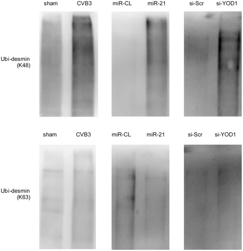 miR-21 mediates K48-linked polyubiquitination of desmin during CVB3 infection.