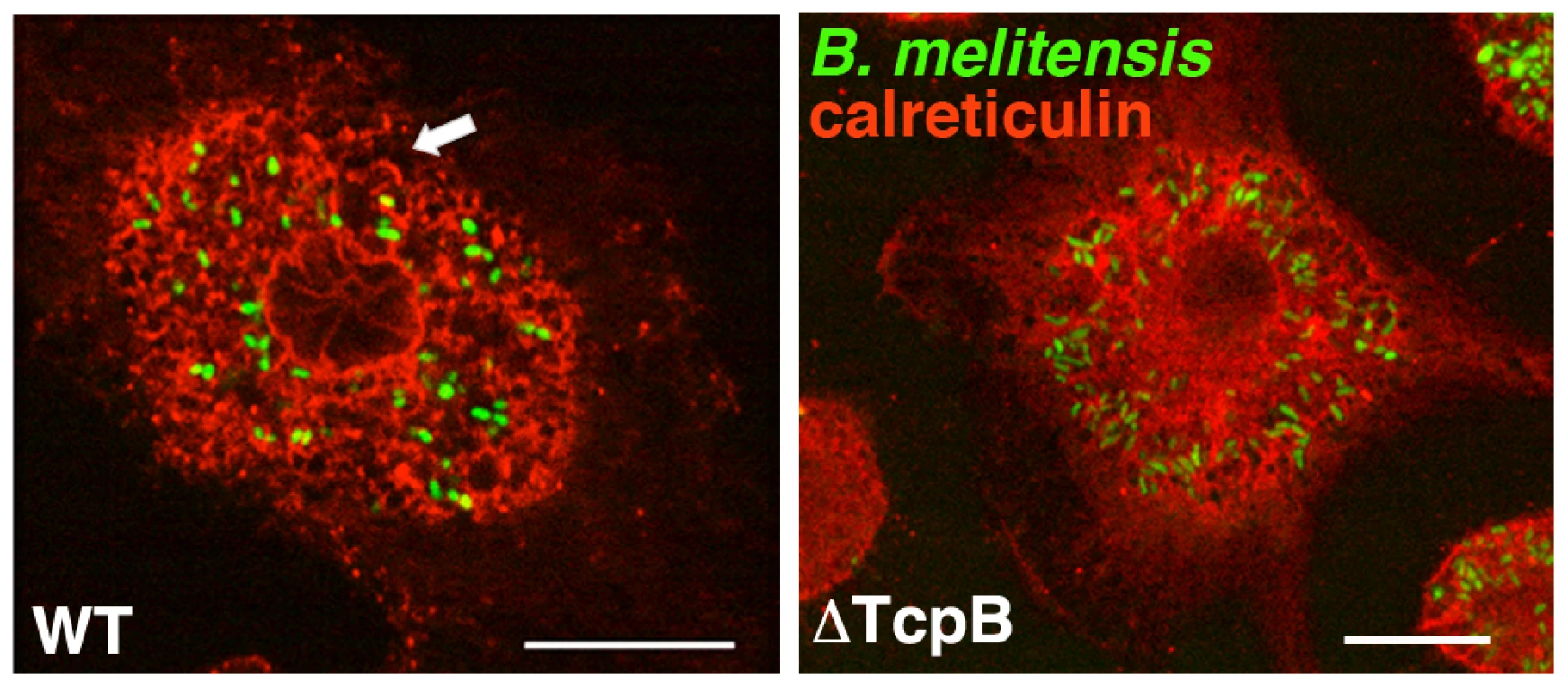 TcpB mutation results in less ER structural disruption following infection.