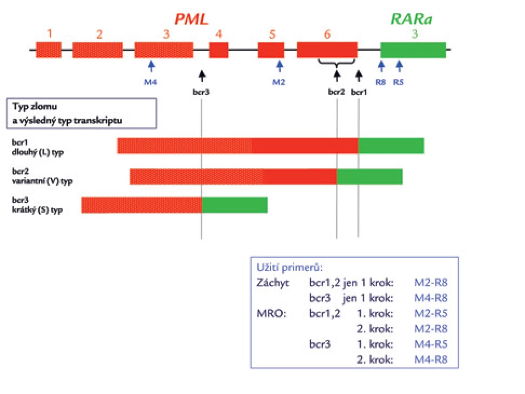 Schematické zobrazení zlomových míst (bcr – breakpoint cluster region) genu PML a výsledných typů transkriptů PML/RARa.