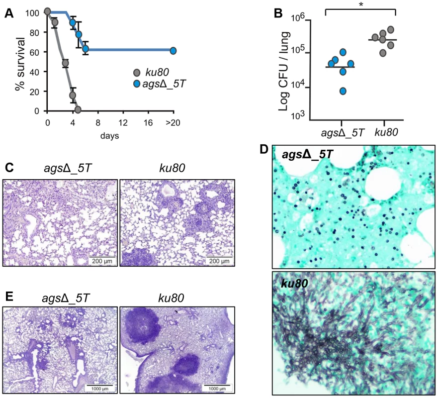Cyclophosphamide immunosuppressed mice and anti-Ly6G treated neutropenic mice infected with resting conidia of <i>ags</i>Δ_<i>5T</i> and parental (<i>ku80</i>) strains.