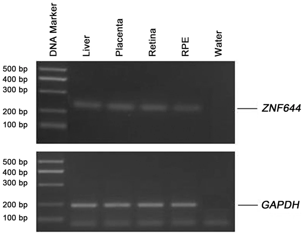 Expression of the <i>ZNF644</i> gene in human tissues.