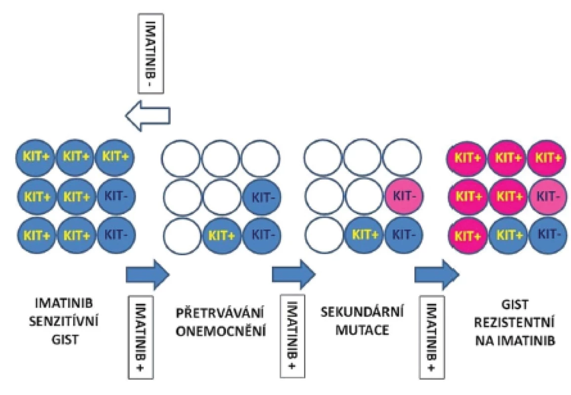 Hypotetický model perzistence kmenových buněk GIST a sekundární rezistence.