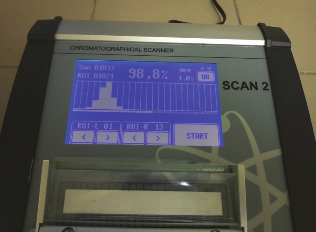Chromatografický skener SCAN 2 pro rychlé a přesné vyhodnocení chromatografie