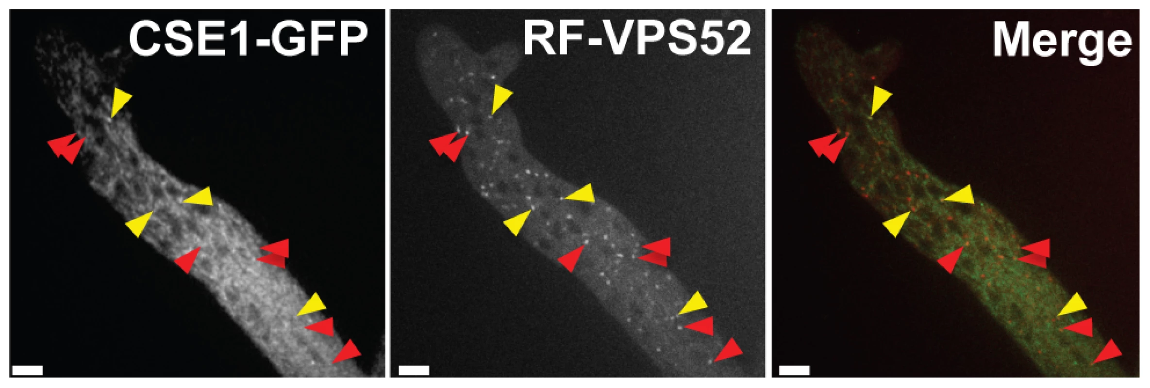 CSE1-GFP and RFP-VPS-52 colocalization.