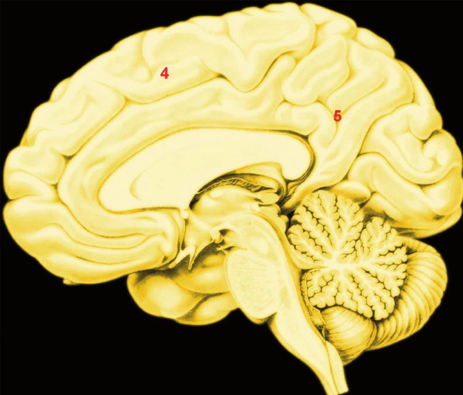 A. B. Přibližná poloha uzlů konektomu aktivovaného mentalizací
Legenda:
5 A – zevní plocha pravé hemisféry;
5 B – vnitřní plocha pravé hemisféry;
1. – temporoparietální junkce;
2. – sulcus temporalis superior zadní část;
3. – temporální pól;
4. – dorsomediální prefrontální kůra;
5. – precuneus a zadní část g. cinguli;
Mentalizace je schopnost rozlišit, že druhý člověk má niterné duševní stavy, například záměry,
tužby, plány, představy, obecně řečeno, že je „agent“.
