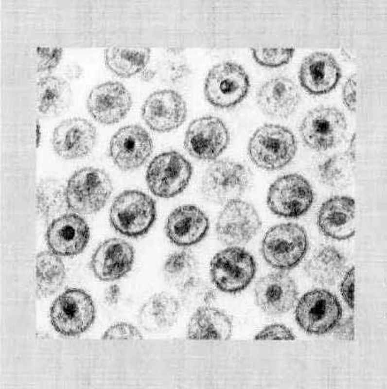 Elektronmikroskopický snímek HIV
Fig. 3. Electron microscopy image of HIV