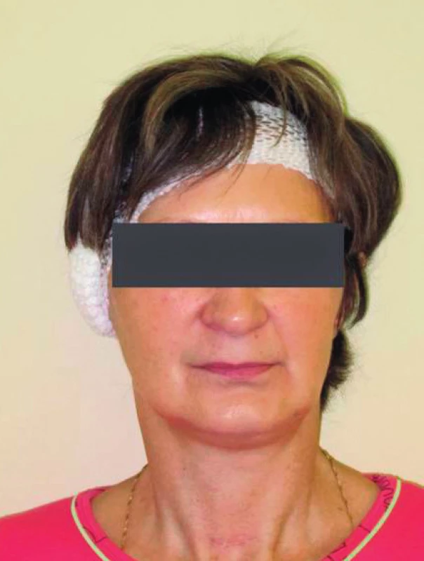 Anatomie obličeje a krku při čelním pohledu bez viditelných deformit či malformací