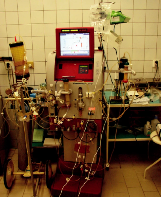 Přístroj O. liver Performer (fy Rand, Itálie) se zapojením bioreaktoru