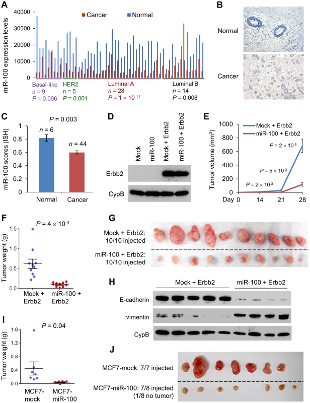 miR-100 inhibits tumorigenesis and is downregulated in human breast cancer.