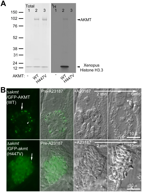 The lysine methyltransferase activity of AKMT is required for its function.