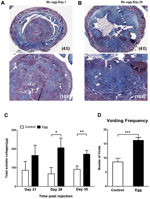 <i>S. haematobium</i> egg-injected bladders develop fibrosis and urinary dysfunction.