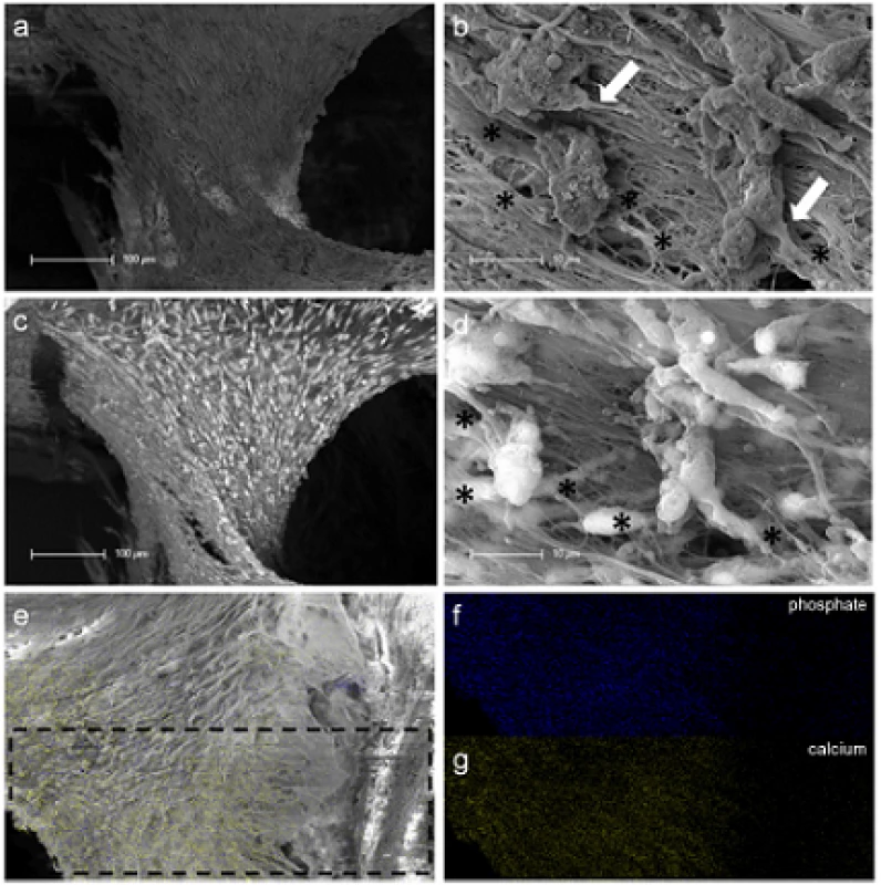 SEM and EDX investigation of merged human pulp cell spheres in a human root canal. Figure (a) shows a fibrillar surface of the closed cell construct with different sized mineral like structures on it (Figure 4b) by detection of secondary electrons. The white arrows in figure (b) represent a cellular connection between the mineral particles and the underlying cell layer. The images in figure (c) and (d) show the same areas investigated by the detection of back scattered electrons with a clearly seen atomic number depending material contrast between the spheres’ cell matrix and the mineral particles. Black asterisks in figure (b) and (d) denote particles with higher atomic numbers, which could only be seen in figure (d) by the aid of the material contrast. The area of the sphere, which was investigated by EDX, is marked with black lines in figure (e). The results concerning the higher concentration of mineral specific elements are represented in figure (f) (phosphate) and figure (g) (calcium).