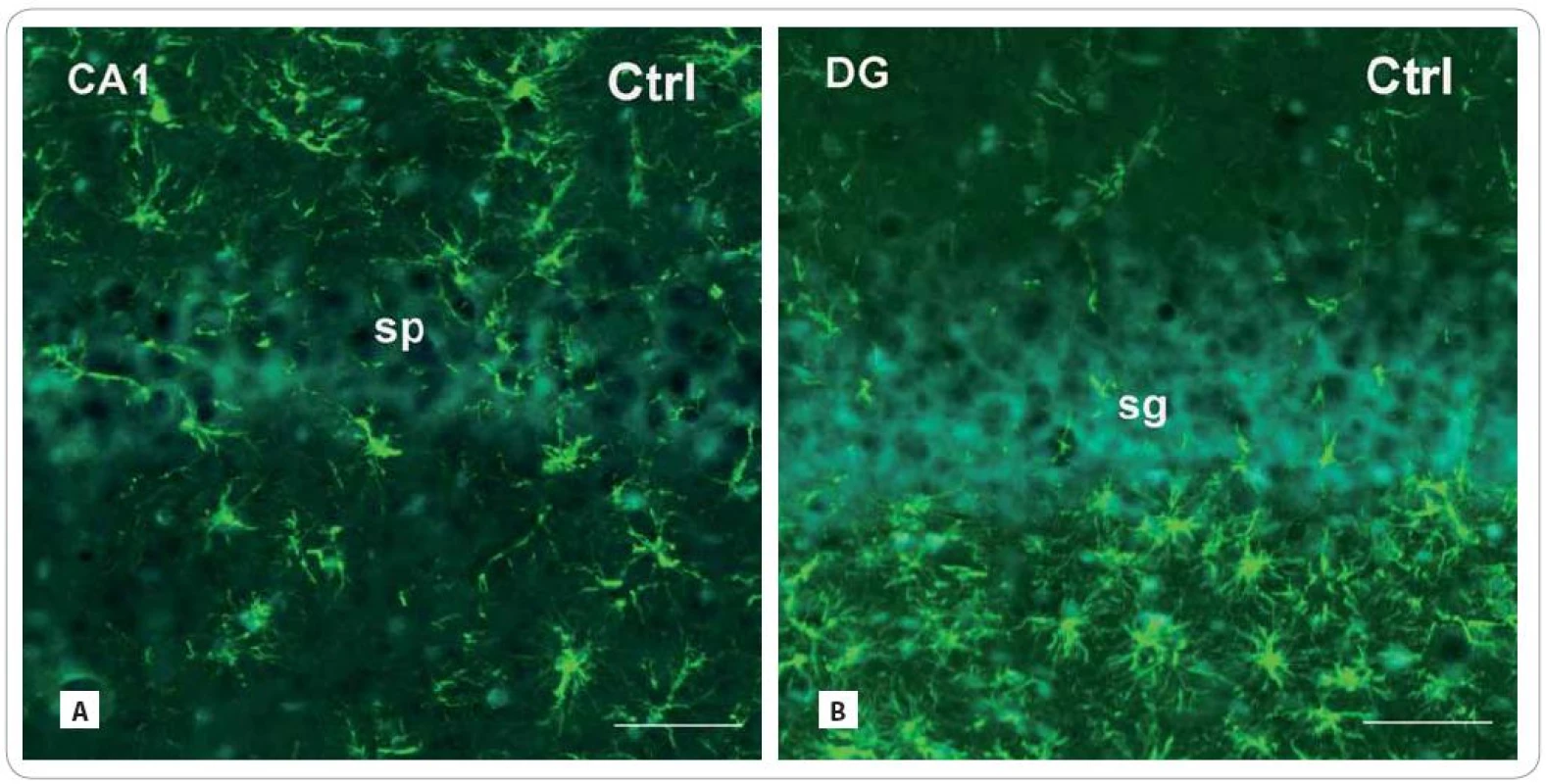Photomicrographs of the sagittal sections through the hippocampus of adult rats showing the principal layers of the CA1 subfield and the DG: str. pyramidale (sp) and str. granulosum (sg), resp. immunofluorescent staining for detection of glial fibrillary acid protein (GFAP) (red or green fluorescent somas and processes, counterstained with blue DAPI nuclear dye), marker for mature astrocytes in control group (A, B) and in the brain of rats, investigated 30 and 100 days after fractionated irradiation (Irr-30, Irr-100) (C–F) with the total dose of 20 Gy of gamma rays.