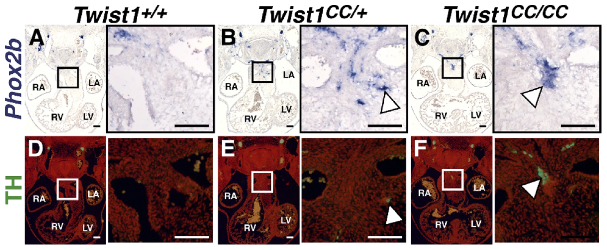 The Twist-box domain of Twist1 is required for repression of ectopic neurogenesis.