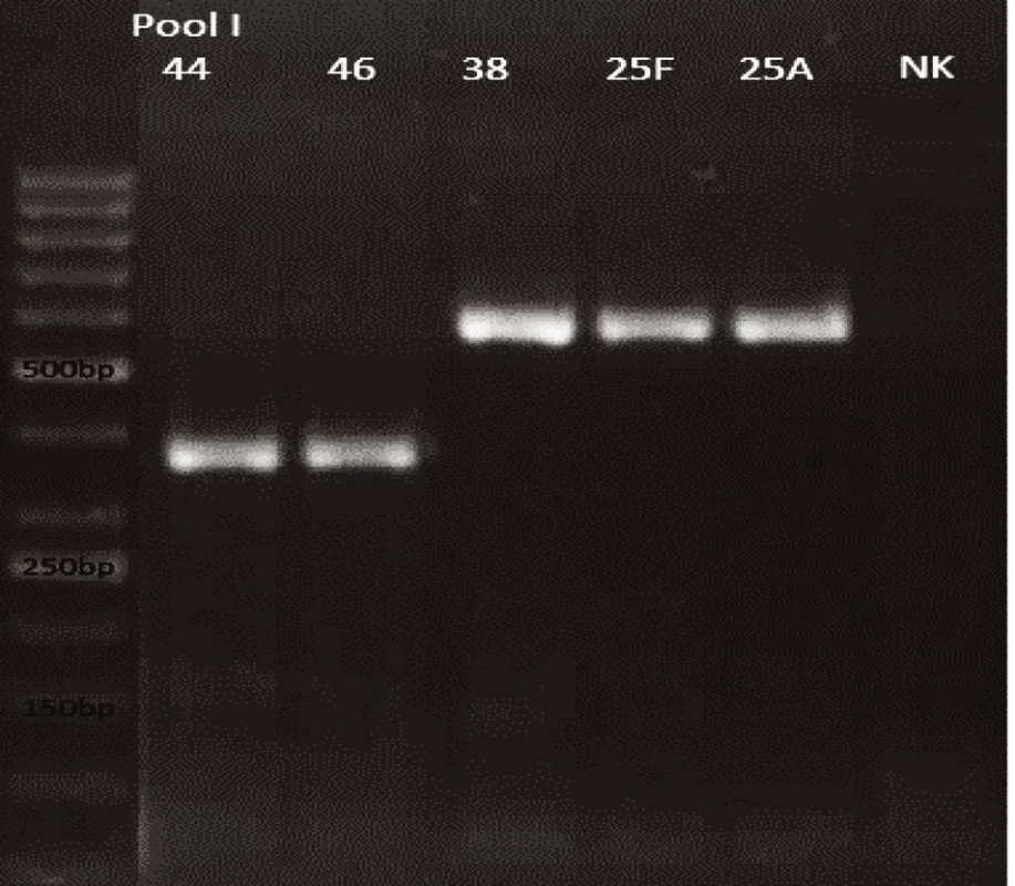 mPCR pool I
Dráha 1: 50bp DNA Ladder
Dráha 2: &lt;i&gt;S. pneumoniae&lt;/i&gt; sérotyp 44 (376bp)
Dráha 3: &lt;i&gt;S. pneumoniae&lt;/i&gt; sérotyp 46 (376bp)
Dráha 4: &lt;i&gt;S. pneumoniae&lt;/i&gt; sérotyp 38 (574bp)
Dráha 5: &lt;i&gt;S. pneumoniae&lt;/i&gt; sérotyp 25F (574bp)
Dráha 6: &lt;i&gt;S. pneumoniae&lt;/i&gt; sérotyp 25A (574bp)
Dráha 7: negativní kontrola
Dráha 2–6: pozitivní produkt cpsA (160bp)&lt;br&gt;
Fig. 9. mPCR pool I
Lane 1: 50bp DNA Ladder
Lane 2: &lt;i&gt;S. pneumoniae&lt;/i&gt; serotype 44 (376bp)
Lane 3: &lt;i&gt;S. pneumoniae&lt;/i&gt; serotype 46 (376bp)
Lane 4: &lt;i&gt;S. pneumoniae&lt;/i&gt; serotype 38 (574bp)
Lane 5: &lt;i&gt;S. pneumoniae&lt;/i&gt; serotype 25F (574bp)
Lane 6: &lt;i&gt;S. pneumoniae&lt;/i&gt; serotype 25A (574bp)
Lane 7: negative control
Lanes 2–6: positive product cpsA (160bp)