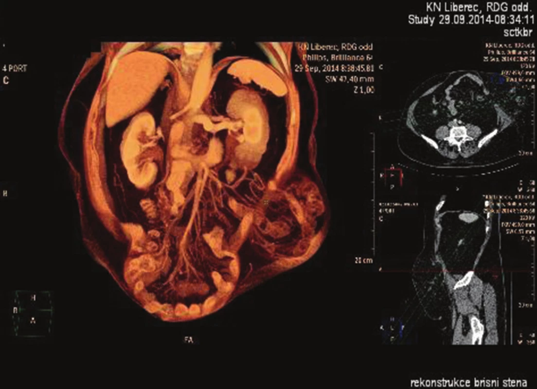CT orgánová rekonstrukce
Fig. 4: CT organ reconstruction