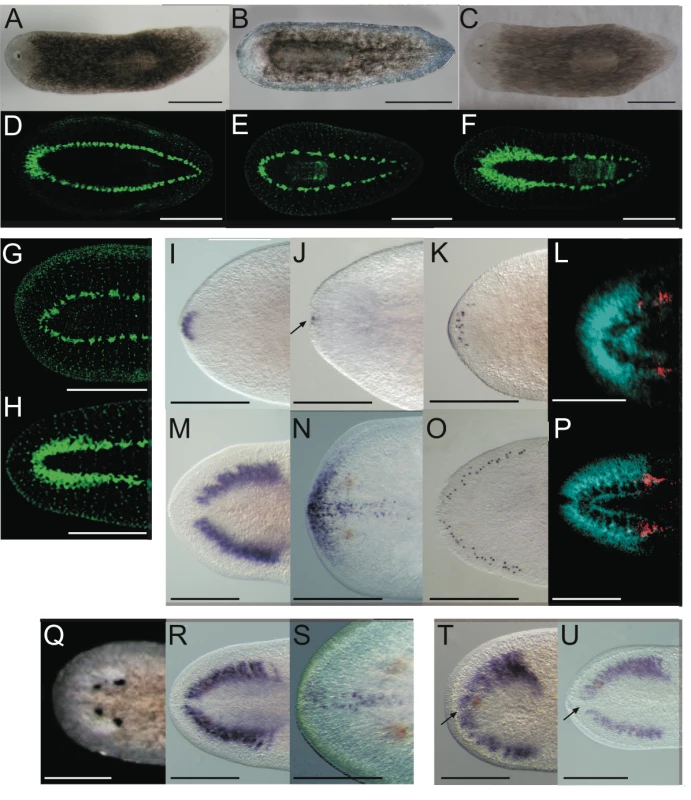 <i>Smed-prep(RNAi)</i> leads to the loss of anterior fate during regeneration.