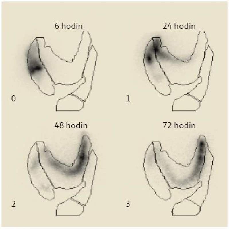 Zájmové oblasti v průběhu tlustého střeva – cékum a vzestupný tračník, příčný tračník, sestupný tračník, rektosigmoideum (syndrom líného střeva).
Fig. 1. ROIs of the colon – caecum and ascending colon, transverse colon, descending colon, rectosigmoideum (colonic inertia syndrome).