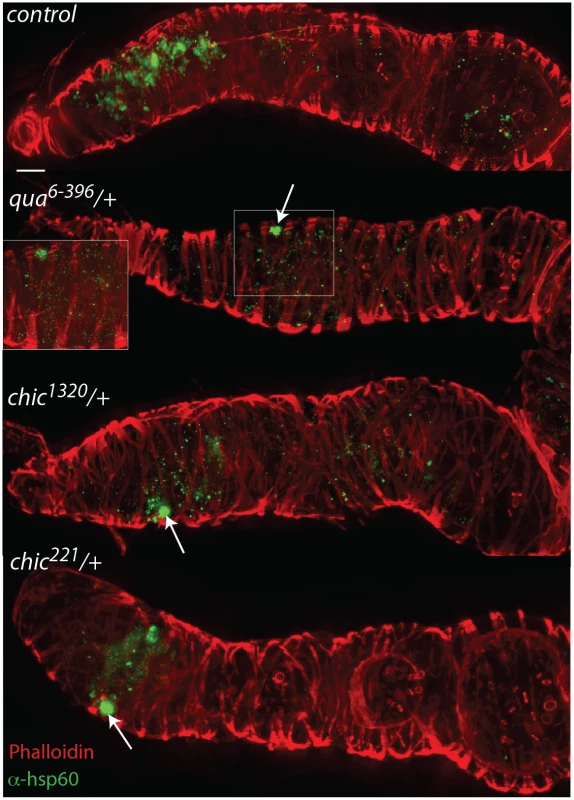 Mutations in actin binding proteins reduce the titer of <i>Wolbachia</i> within the region 2 and early egg chambers in heterozygous mutant flies.