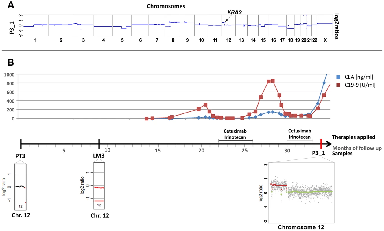 Occurrence of a chromosomal 12p polysomy under cetuximab therapy in patient #26C1.