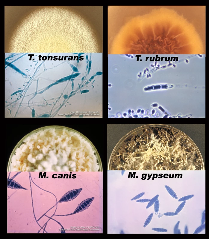 Major dermatophyte species—appearance in the laboratory.