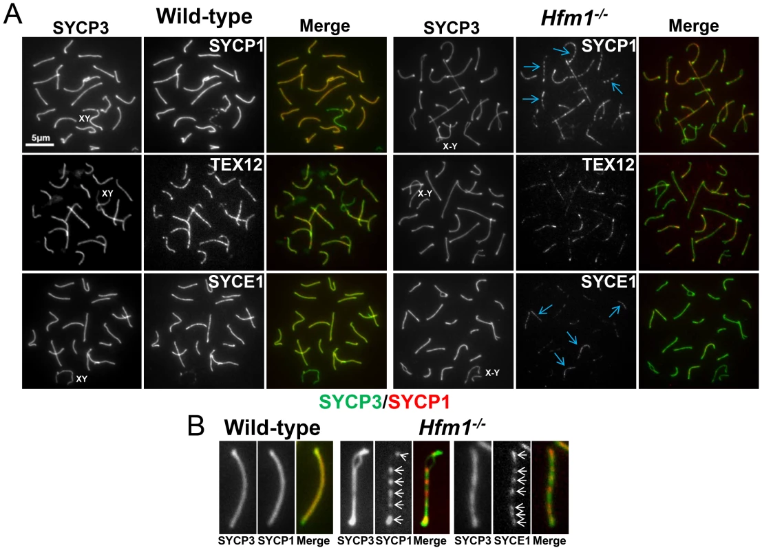 Synaptic defects in <i>Hfm1<sup>−/−</sup></i> spermatocytes.