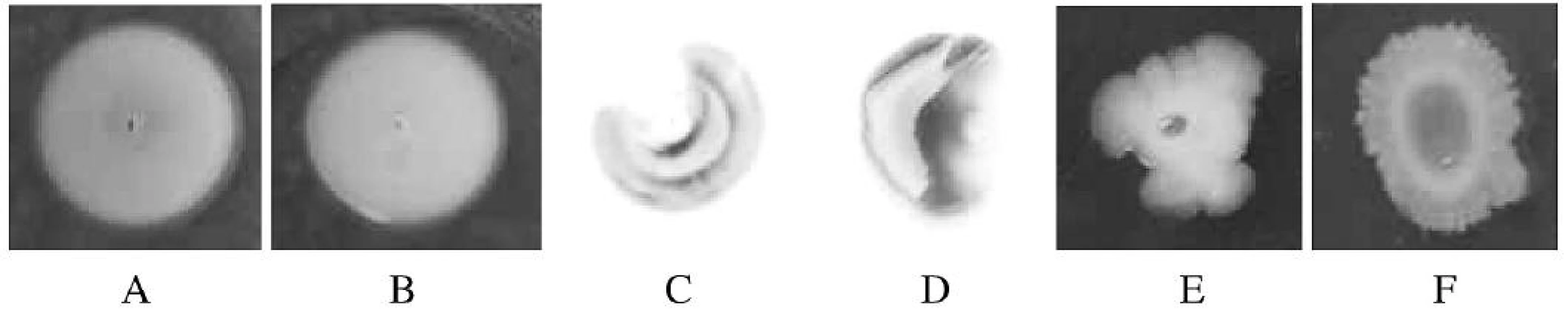 Test na swimming (A, B), twitching (C, D) a swarming (E, F) motilitu

Fig. 2. Swimming (A, B), twitching (C, D), and swarming (E, F) motility assays