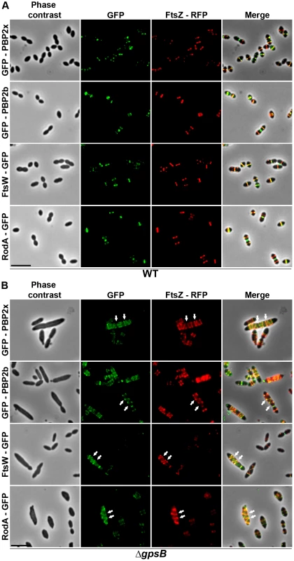 Localization of GFP fused PBP2x, PBP2b, FtsW or RodA together with FtsZ-RFP in WT and Δ<i>gpsB</i> cells.