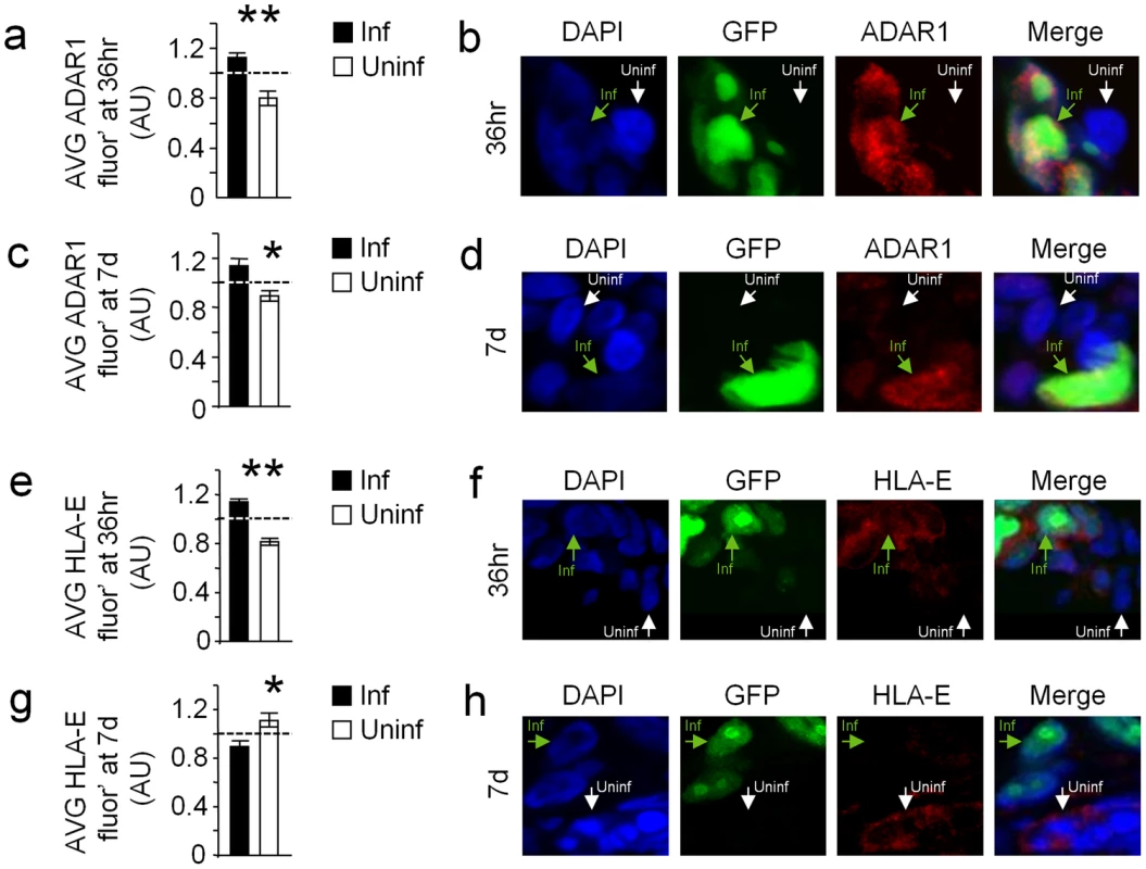 HCMV infection of human decidua organ culture induces ADAR1 and reduces HLA-E expression.