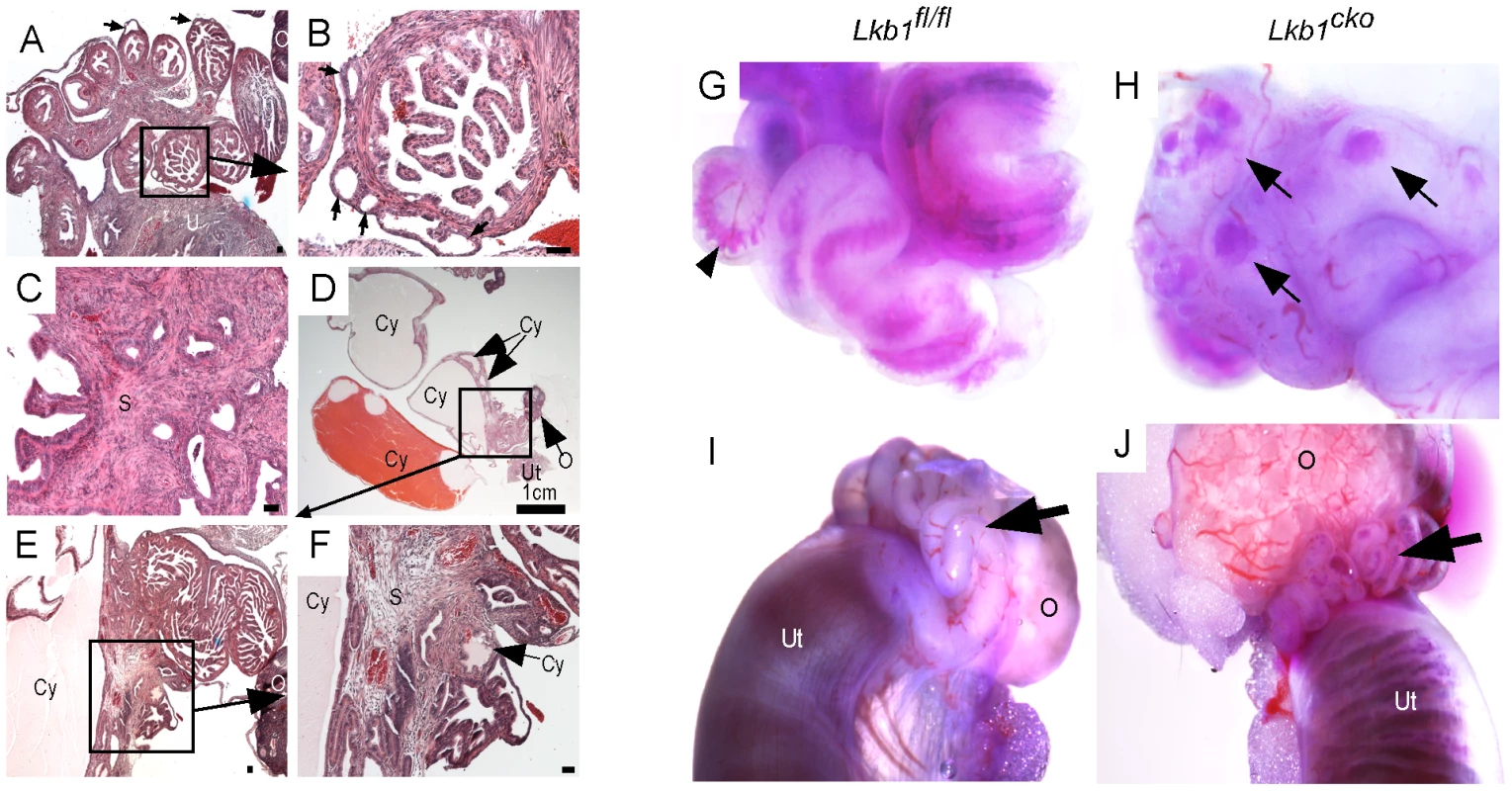 Hyperplastic and/or cystic growth in oviducts of <i>Lkb1<sup>cko</sup></i> mice.