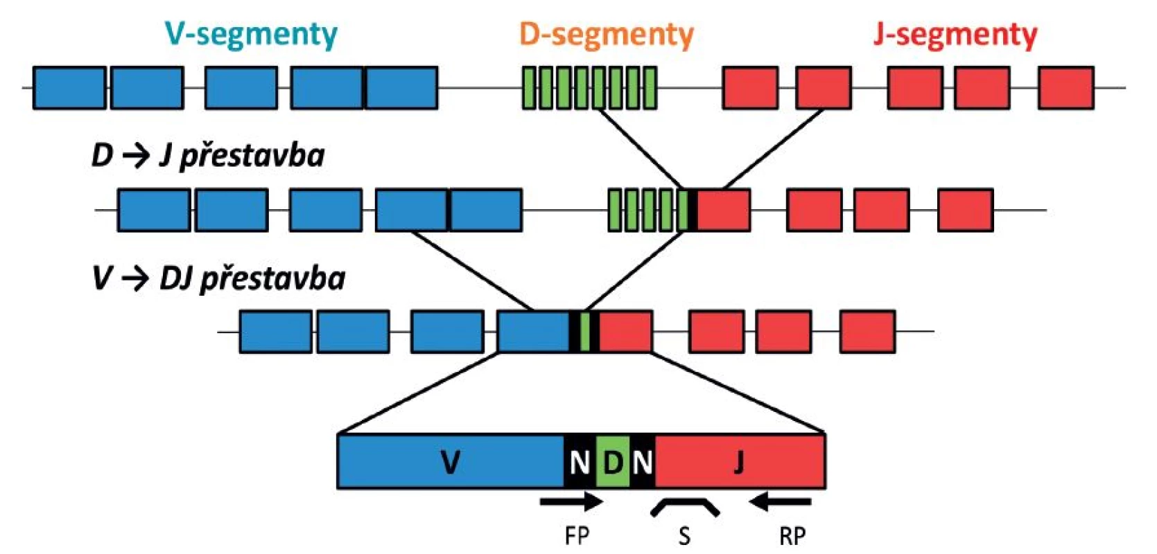 Schéma V-D-J přestavby imunoreceptorového genu a naznačení polohy primerů a sondy pro detekci MRN.