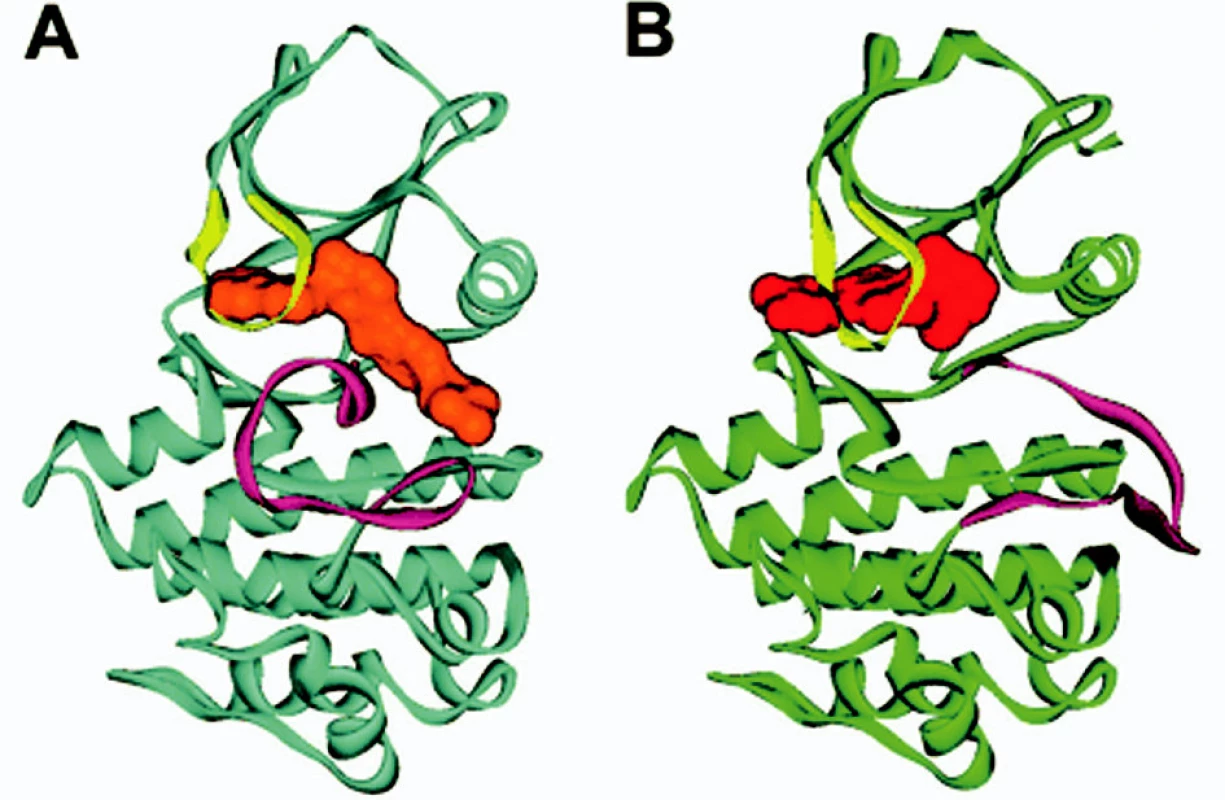 Stuhová prostorová struktura ABL (modrá barva) s imatinibem (oranžová barva) a pro srovnání s jiným inhibitorem (PD 180970, červená barva, ABL zelená barva). A smyčka (fialová) v uzavřené poloze v případě imatinibu (část A obrázku), pro srovnání v otevřené poloze s jiným inhibitorem (část B obrázku). P smyčka (žlutá barva) je pohnuta inhibitorem v obou případech (viz také tab. 3). Upraveno dle Deininger et al. (4).