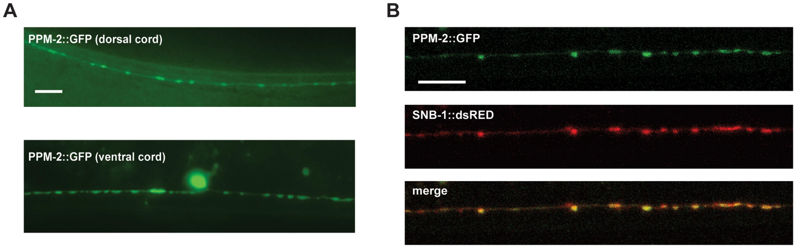 PPM-2 localizes to the presynaptic terminal.