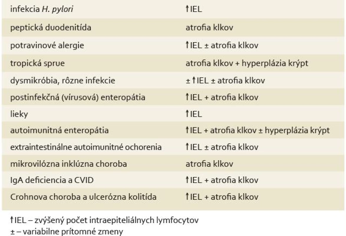 Histologická diferenciálna diagnostika céliakie.
Tab. 3. Histological differential diagnostics of celiac disease.